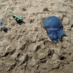 „БОЛКАТА Е НЕОПИСЛИВА, СЕ ОПОРАВУВАМ ТРИ ГОДИНИ! Отишле од плажа во АГОНИЈА – Ја сожалиле, а таа страшно ги ПРОБОДИЛА!