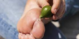КАКО ПРИРОДНО ДА ГИ ОТСТРАНИТЕ БРАДАВИЦИТЕ ВО БИЛО КОЈ ДЕЛ ОД ТЕЛОТО?