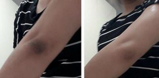 Овој ДЕЛ ОД ТЕЛОТО често се занемарува кога се грижите за себе, а СИТЕ ГО ГЛЕДААТ ОСВЕН ВИЕ!