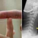 Не паничете: Што да направите ако ви се заглави коска од риба во грлото? Направете го ова веднаш