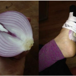 Спиев со кромид во чорапите САМО ЕДНА НОЌ а резултатот е неверојатен