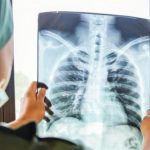 6 СИМПТОМИ НА СКРИЕНА ПНЕВМОНИЈА: Сигурни знаци дека инфекцијата се проширила на белите дробови!