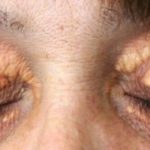 ЈА СТАВИВ ОВАА НАМИРНИЦА НА МАСНОТО ТКИВО ОКОЛУ ОКОТО, СИТЕ ГО ИМАТЕ ДОМА!