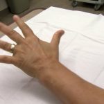 ДАЛИ ВИ ТРНАТ РАЦЕТЕ ИЛИ ПРСТИТЕ? ЕВЕ ШТО ВЕ ПРЕДУПРЕДУВА ОВОЈ СИМПТОМ: Обрнете внимание на време!