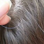 Ако предвреме ПОБЕЛИТЕ, не мора да значи дека тоа е поради генетиката! Овие 4 состојби покажуваат дека нешто не е во ред!