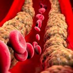 5 НАМИРНИЦИ КОИ ГО НАМАЛУВААТ НИВОТО НА ХОЛЕСТЕРОЛ ВО КРВТА: Што треба да јадете ако сакате да ги исчистите крвните садови!