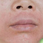 ЛЕКАРИТЕ ПРЕДУПРЕДУВААТ – НЕ ИГНОРИРАЈТЕ: 1 навидум безопасен симптом околу устата укажува на замастен црн дроб