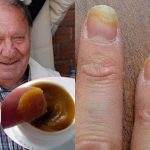 БИЛКАР РАДЕ ОТКРИ ДОМАШЕН РЕЦЕПТ ПРОТИВ ГАБИ И НЕПРАВИЛНИ НОКТИ: Потребни ви се само ОВИЕ 3 СОСТОЈКИ!