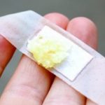 Земете лук, ставете го на фластер и залепете го на кожата! Погледнете што ќе се случи