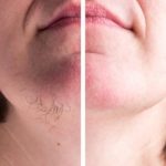 ЕВЕ ЗОШТО РАСТАТ ТЕМНИ ОСТРИ ВЛАКНА – Доколку се придружени со овие симптоми, веднаш обратете се на ЛЕКАР!