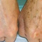 Лек од 3 состојки кој ја омекнува кожата како на бебе, ги избелува старечките пеги, дамките и брчките