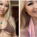 Не може да седи или да оди во тоалет: По естетската операција, има ГОЛЕМИ проблеми, но благодарение на тоа заработува МИЛИОНИ