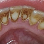 АКО ИМАТЕ забен камен, ова се двете клучни работи за кои грешите
