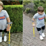 Момче без нозе пешачеше 10 километри за да собере пари за болницата