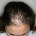 Слаба коса и нокти, замор, бледило, недостаток на концентрација? ЕВЕ ШТО НЕМА НА ВАШЕТО ТЕЛО