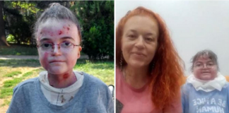 АНА Е ДЕТЕ ПАПЕРУТКА ИМА 20 ГОДИНИ И ИМА ПОТРЕБА ОД НАС, ЈА БОЛИ СЕКОЈ ДОПИР, ВО СЕКОЈ МОМЕНТ (ФОТО)