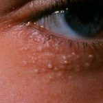 ЗНАЕТЕ ЛИ КОИ ШТО СЕ ОВИЕ БЕЛИ ТОЧКИ НА ВАШЕТО ЛИЦЕ? Еве што треба да направите