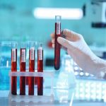 CRP НЕ ВИ Е ДОБАР АКО ГИ ИМАТЕ ОВИЕ ВРЕДНОСТИ: Еве како ќе знаете кога е нормален а кога е покачен