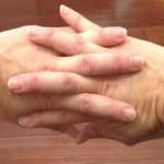 Лекарите објаснуваат зошто КРЦКАЊЕТО НА ПРСТИТЕ ОД РАЦЕТЕ е многу штетно