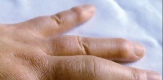 Лек за отечени и болни раце – делува веднаш, болката ќе ја снема