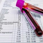 КАКО ДА ГИ НАМАЛИТЕ МАСНОТИИТЕ ВО КРВТА: Овие две состојки го елиминираат вишокот маснотии од крвта!