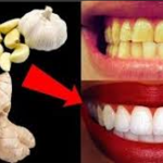 (Видео)За две минути, забите ќе ви станат бели и сјајни како бисери