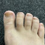 ДАЛИ ИМАТЕ ГАБИ И ЖОЛТИ, ЗАДЕБЕЛЕНИ НОКТИ: Само нанесете го ова масло и ќе го решите проблемот преку ноќ!