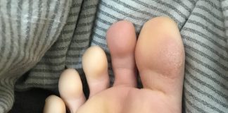 ВАШИТЕ НОЗЕ СЕ ПОСТОЈАНО ЛАДНИ И НЕВОЗМОЖНО Е ДА ГИ ЗАГРЕЕТЕ: Еве што треба да направите!