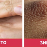 7 работи кои можат да му се случат на вашето тело во зимскиот период