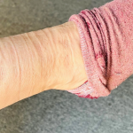 Дали добивате траги на нозете кога ги соблекувате чорапите? Еве што кажува за вашето здравје, не ја игнорирајте оваа појава