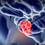 „Чистење“ на дебелото црево на природни начини, најлесниот начин за отстранување на бактериите и токсините