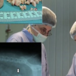 Природен лек за исфрлање на камен од бубрезите