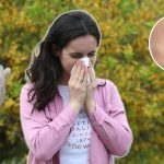 ДОКТОР ОД СРБИЈА ОТКРИВА КАКО ДА СЕ СПРЕЧИ ПОЈАВА НА АЛЕРГИИ: Избегнувајте ваков контакт и ќе бидете безбедни!