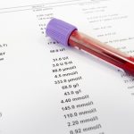 Заради ова ви се лоши наодите: Доктор ги откри најголемите грешки што ги правиме пред земање крв