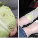 Обвивките од зелка СЕ ЛЕК: ЕВЕ ШТО ЌЕ СЕ СЛУЧИ АКО ГИ СТАВИТЕ НА ГРАДИТЕ, НОЗЕТЕ, РАЦЕТЕ ИЛИ ВРАТОТ!