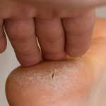 Внимателно погледнете ги стапалата: Доколку ги забележите ОВИЕ ПРОМЕНИ, веднаш посетете лекар!