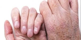 Не можела да живее од силни болки: Со оваа храна ги опоравила коските и зглобовите за 10 дена!