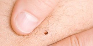 СТАВЕТЕ ЈА ОВАА НАМИРНИЦА НА КРЛЕЖОТ И ЌЕ ПОБЕГНЕ САМ: Сите ја имате во кујната, важно е само да реагирате БРЗО!