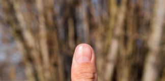 ДАЛИ ЗАБЕЛЕЖАТЕ ЦРНА ЛИНИЈА НА НОКТОТ? Ова е предупредувањето на телото: Еве што е во прашање