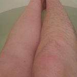 ДАЛИ ВИ болат НОЗЕТЕ НАВЕЧЕР? ТОА НЕ Е ДОБАР ЗНАК: Ако имате уште еден од овие 6 симптоми, ИТНО обратете се на лекар!