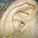 СИМПТОМИ КОИ СИТЕ ГИ ИГНОРИРАТЕ УКАЖУВААТ НА ОПАСНО ВОСПИЛУВАЊЕ: Доктор вели ги имаат често, но НЕ СЕ ИСПИТУВА!