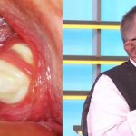 Редовно ги миете забите, но пак излегува непријатен здив: Д-р Перишиќ објасни како се лекува тоа