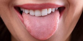 Ако на јазикот забележите некоја од овие промени: Можеби тоа е причината поради која не се чувствувате најдобро…