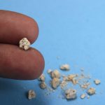 Рецептот на чичко Стојан: Како го исфрлив каменот од бубрег за 21 ден