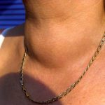 Лекарите објаснија како стресот влијае на лимфните јазли: Многу е важно да знаете како да реагирате во ситуација